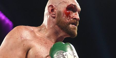 Tyson Fury's cut against Otto Wallin a wake up call ahead of Wilder rematch