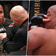 Daniel Cormier loses sight in his eye during controversial UFC 252 loss