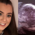 Virgin shocked to discover she’s pregnant