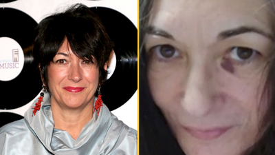 Ghislaine Maxwell pictured with ‘black eye’ in first photo from prison