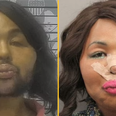 Woman pleads guilty to robbing bank for plastic surgery money