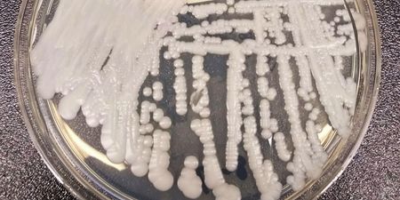 Deadly drug-resistant fungus spreading in America