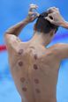 What are the dark circles on swimmers’ backs at Tokyo Olympics?