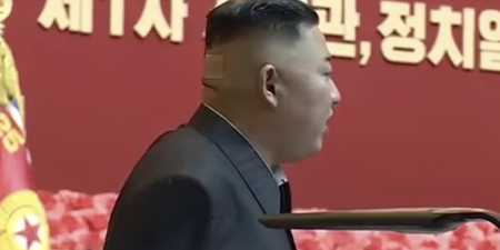 Kim-Jong un spotted with plasters and mystery spots on back of head amid health rumours