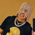 Rapper gets gold chains surgically implanted into his head as ‘hair’
