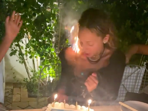 Nicole Richie lights hair on fire during birthday dinner