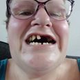 Desperate mum pulls out 11 of her own teeth because she couldn’t find a dentist