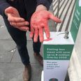 Vegan installs hand sanitiser dispenser ‘full of blood’ outside butchers
