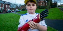 Boy fitted with £10,000 bionic ‘Iron Man’ arm