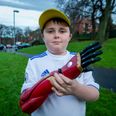 Boy fitted with £10,000 bionic ‘Iron Man’ arm