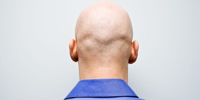 Commenting on baldness is sexual harassment