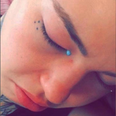 Woman goes blind and cries blue tears after having eyeballs tattooed