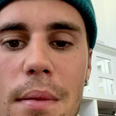 Justin Bieber says ‘Jesus is with him’ while dealing with facial paralysis struggle