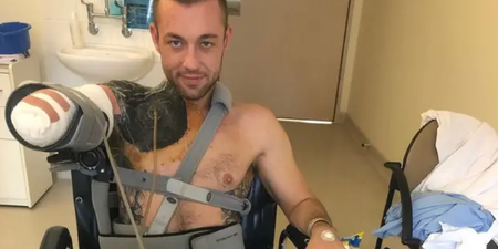 Man wakes up from coma to find he’s lost his arm after gym injury turned into ‘flesh eating’ infection