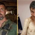Ukraine prisoner of war shows shocking toll Russian captivity had on his body