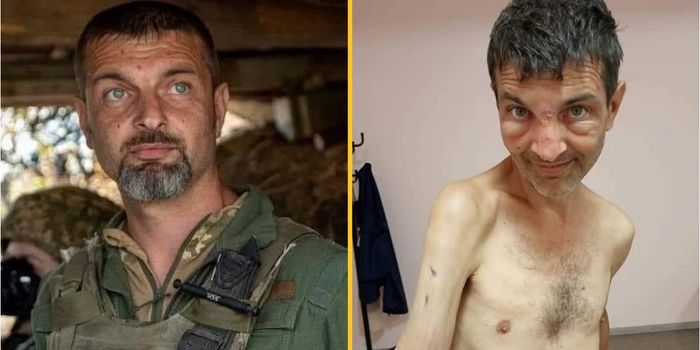 Ukraine prisoner of war shows shocking toll Russian captivity had on his body