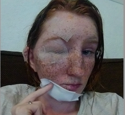 Woman’s freckles melted off after brother-in-law attacked her with boiling water during row over pet rat