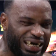 Kickboxer loses row of front teeth in horror incident during fight