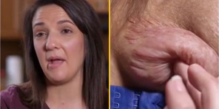 Woman has surgery to have ‘third arm’ removed – only for it to grow back even bigger