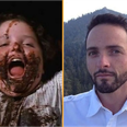 Bruce Bogtrotter star quit acting after Matilda to become a doctor