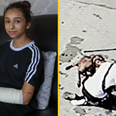 Girl, 11, attacked by XL bully in Birmingham says the dog should be put down and its owner jailed
