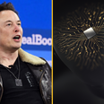 Elon Musk says his company has implanted a wireless chip in someone’s brain