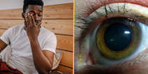 People baffled after discovering what yellow ‘sleep’ in eyes when you wake up really is