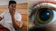 People baffled after discovering what yellow 'sleep' in eyes when you wake up really is