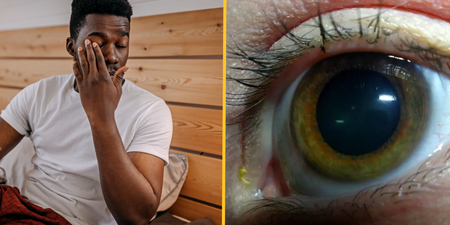 People baffled after discovering what yellow ‘sleep’ in eyes when you wake up really is