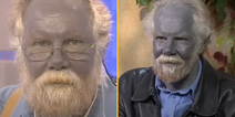 The bizarre case of the ‘real life Papa Smurf’ who turned himself blue
