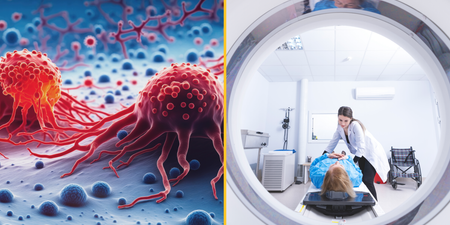 Groundbreaking new method destroys 99% of cancer cells, scientists claim