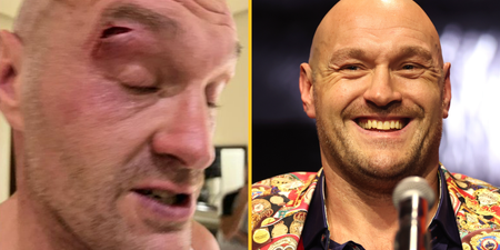 Tyson Fury may never fight again according to former champion