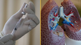 ‘Groundbreaking’ lung cancer vaccine in development