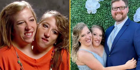 Everyone is asking the same question after conjoined twin Abby Hensel got married