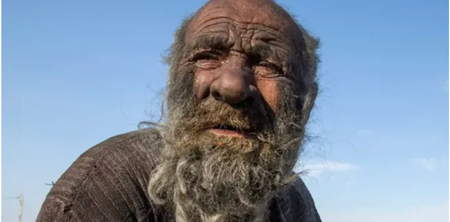 ‘World’s dirtiest man’ who went decades without washing died after finally agreeing to have a bath